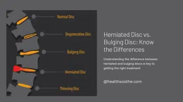 Herniated Disc vs. Bulging Disc: Know the Differences