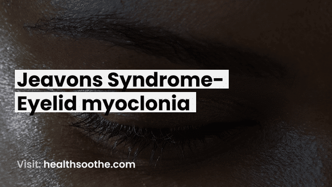 Jeavons Syndrome - Eyelid Myoclonia