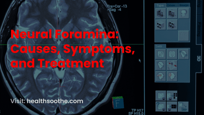 Neural Foramina_ Causes, Symptoms, and Treatment