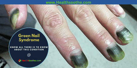 green nail syndrome - Healthsoothe