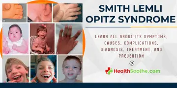 Smith Lemli Opitz Syndrome - Healthsoothe