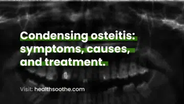 Condensing osteitis