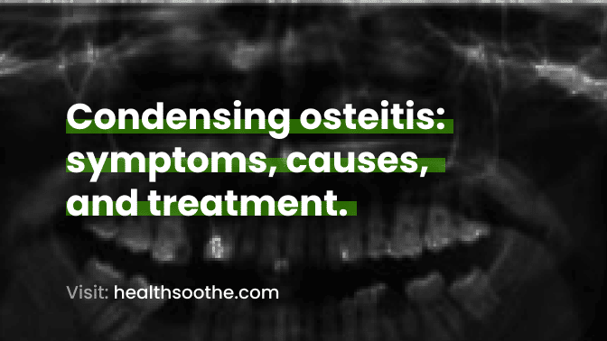 Condensing Osteitis