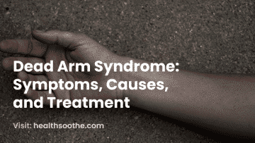 Dead Arm Syndrome_ Symptoms, Causes, And Treatment