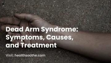 Dead Arm Syndrome_ Symptoms, Causes, and Treatment