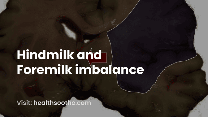 Hindmilk and Foremilk imbalance