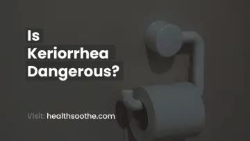 Is Keriorrhea Dangerous_