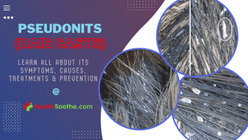 Pseudonits - Healthsoothe
