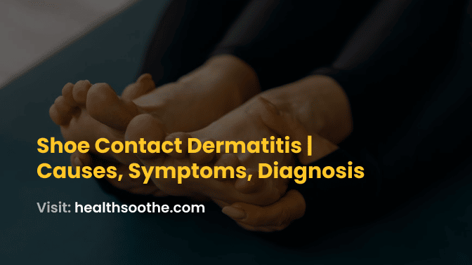 Shoe Contact Dermatitis _ Causes, Symptoms, Diagnosis