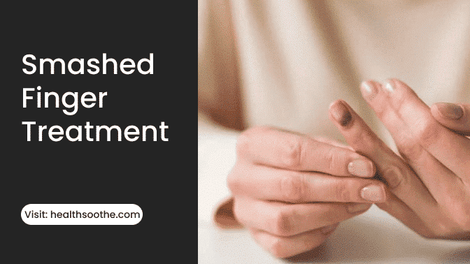 Smashed Finger Treatment 