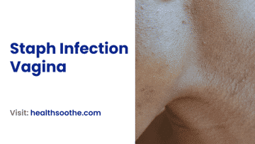 Staph infection vagina