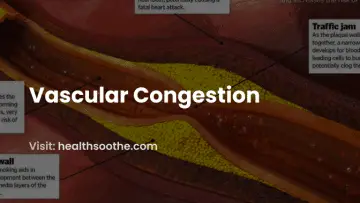 Vascular Congestion