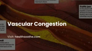 vascular congestion