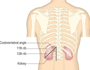 Costovertebral Angle: Costovertebral Angle Tenderness - Healthsoothe