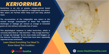 keriorrhea - Healthsoothe