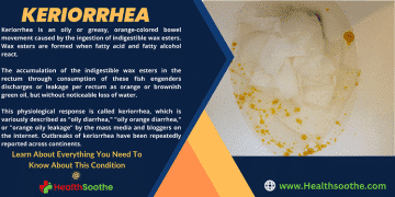 Keriorrhea - Healthsoothe