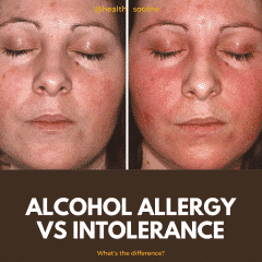 Alcohol Allergy