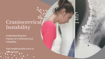 Overcoming Pain & Discomfort – Understanding the Impact of Craniocervical Instability