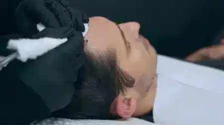 What Happens During a Scalp Micropigmentation Los Angeles?