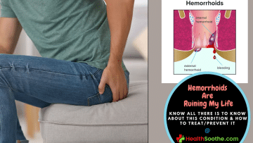 hemorrhoids are ruining my life - Healthsoothe