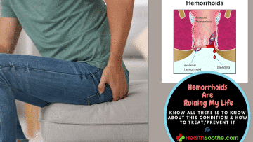 Hemorrhoids Are Ruining My Life - Healthsoothe