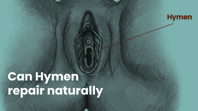 Can Hymen repair naturally