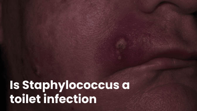 Is Staphylococcus a toilet infection