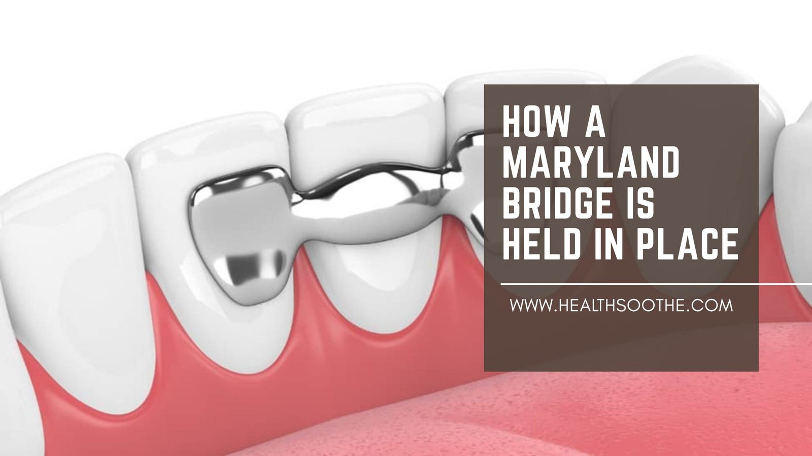 How A Maryland Bridge Is Held In Place: Materials, Benefits & Lifespan Explained