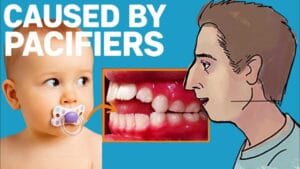 Pacifier Teeth