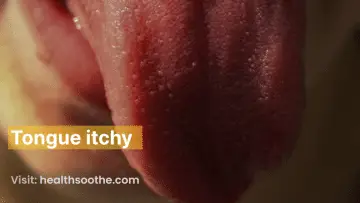 Tongue itchy