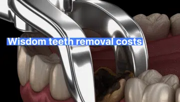 Wisdom teeth removal costs