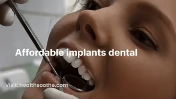 affordable implants dental