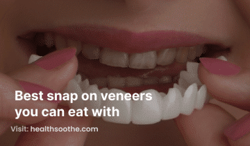 best snap on veneers you can eat with
