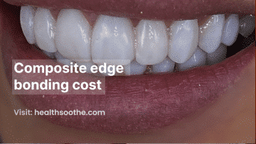 Composite Edge Bonding Cost