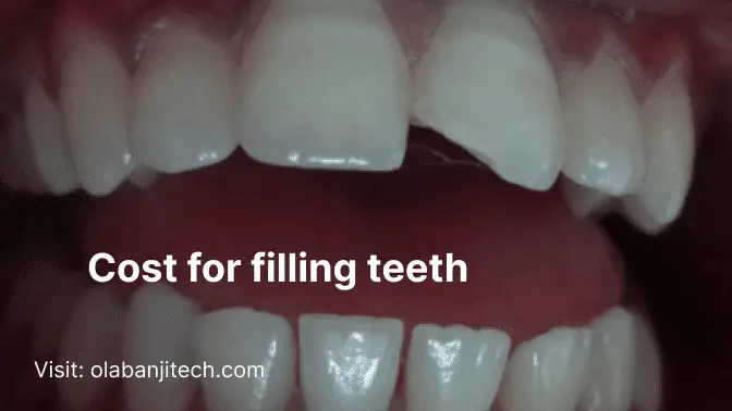 cost for filling teeth