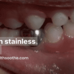 crown stainless steel