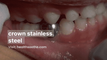 crown stainless steel