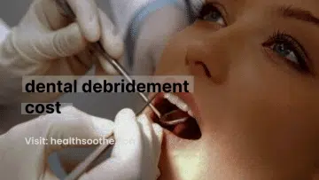 dental debridement cost