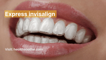 express invisalign