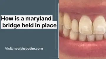 how is a maryland bridge held in place