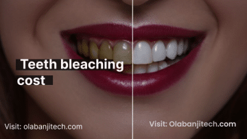 teeth bleaching cost