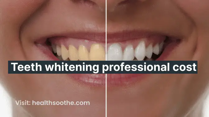 teeth whitening professional cost