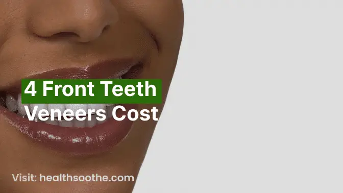 4 Front Teeth  Veneers Cost