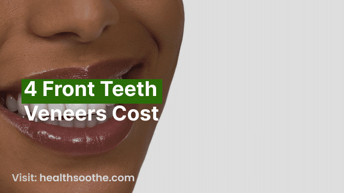 4 Front Teeth  Veneers Cost