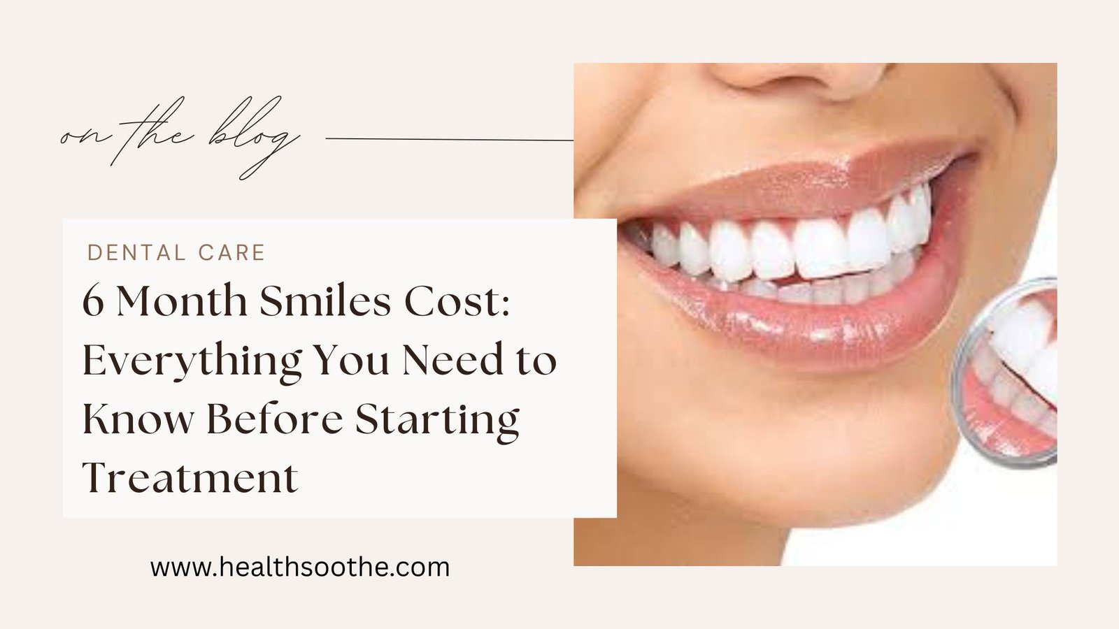 6 Month Smiles Cost: Everything You Need To Know Before Starting Treatment