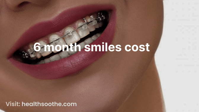 6 month smiles cost