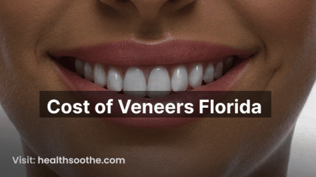 Cost of Veneers Florida
