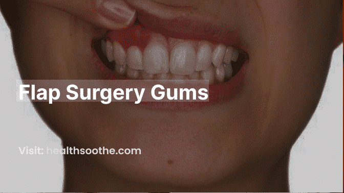 Flap Surgery Gums