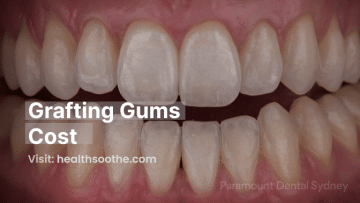 Grafting Gums Cost