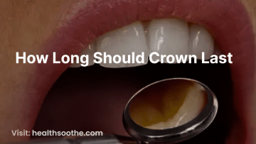 How Long Should Crown Last